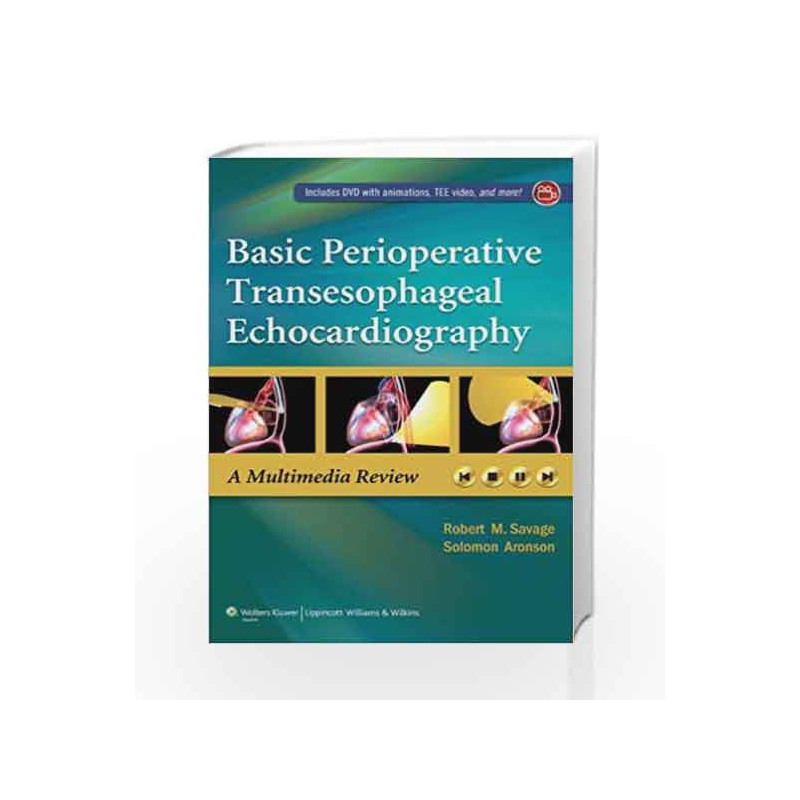 Basic Perioperative Transesophageal Echocardiography by Savage R.M. Book-9781451190465
