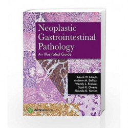 Neoplastic Gastrointestinal Pathology: An Illustrated Guide by Lamps L W Book-9781936287727