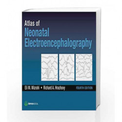 Atlas of Neonatal Electroencephalography by Mizrahi E M Book-9781620700679