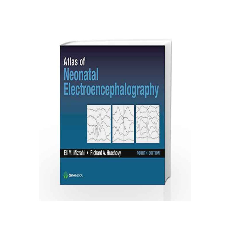 Atlas of Neonatal Electroencephalography by Mizrahi E M Book-9781620700679