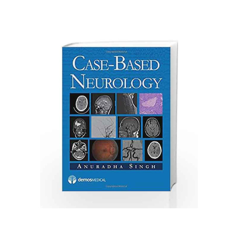 Case-Based Neurology by Singh A Book-9781933864259