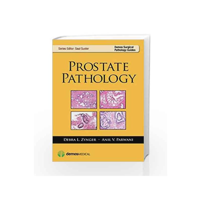 Prostate Pathology (Demos Surgical Pathology Guides) by Zynger D L Book-9781936287901