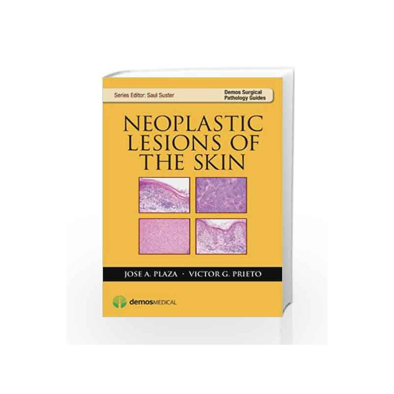 Neoplastic Lesions of the Skin (Demos Surgical Pathology Guides) by Plaza J A Book-9781933864860