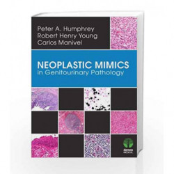 Neoplastic Mimics in Genitourinary Pathology (Pathology of Neoplastic Mimics) by Humphrey P A Book-9781620700204