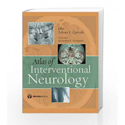 Atlas of Interventional Neurology by Qureshi A I Book-9781933864310