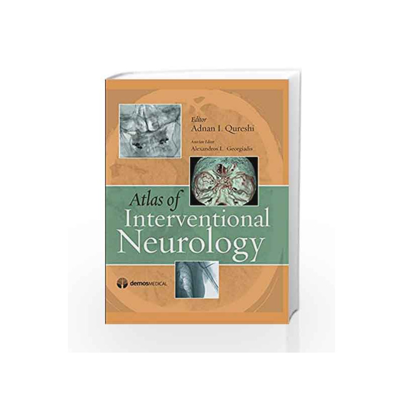 Atlas of Interventional Neurology by Qureshi A I Book-9781933864310