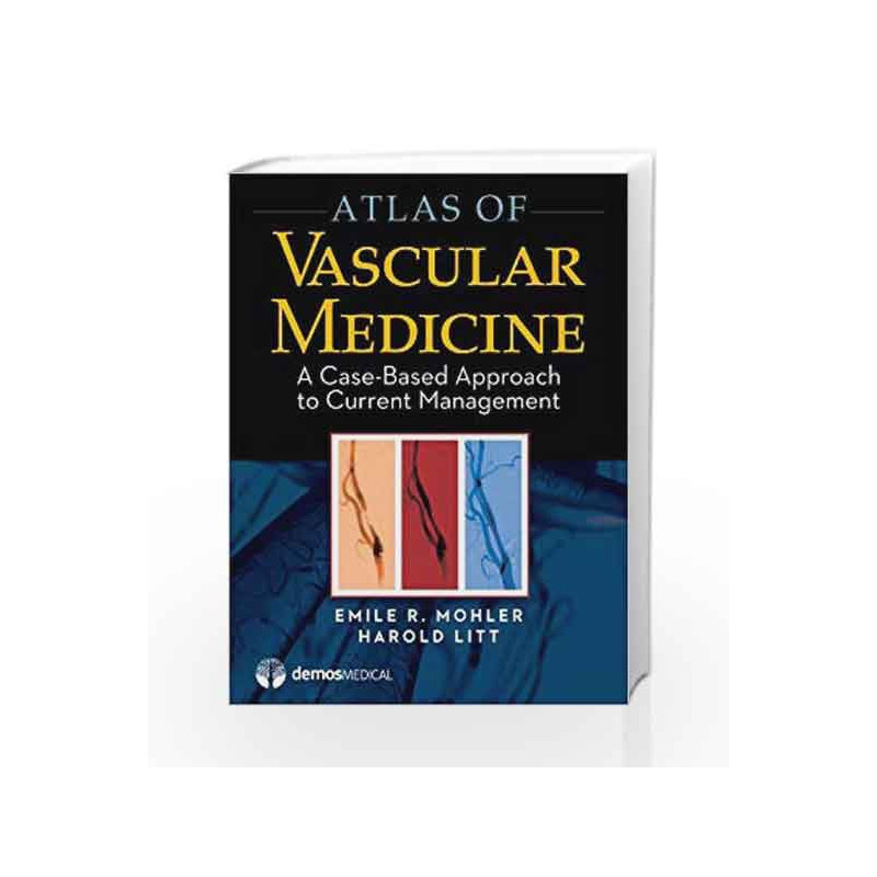 Atlas of Vascular Medicine: A Case-Based Approach to Current Management by Mohler E R Book-9781936287291