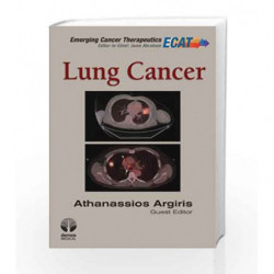 Lung Cancer (Emerging Cancer Therapeutics) by Argires Book-9781936287529