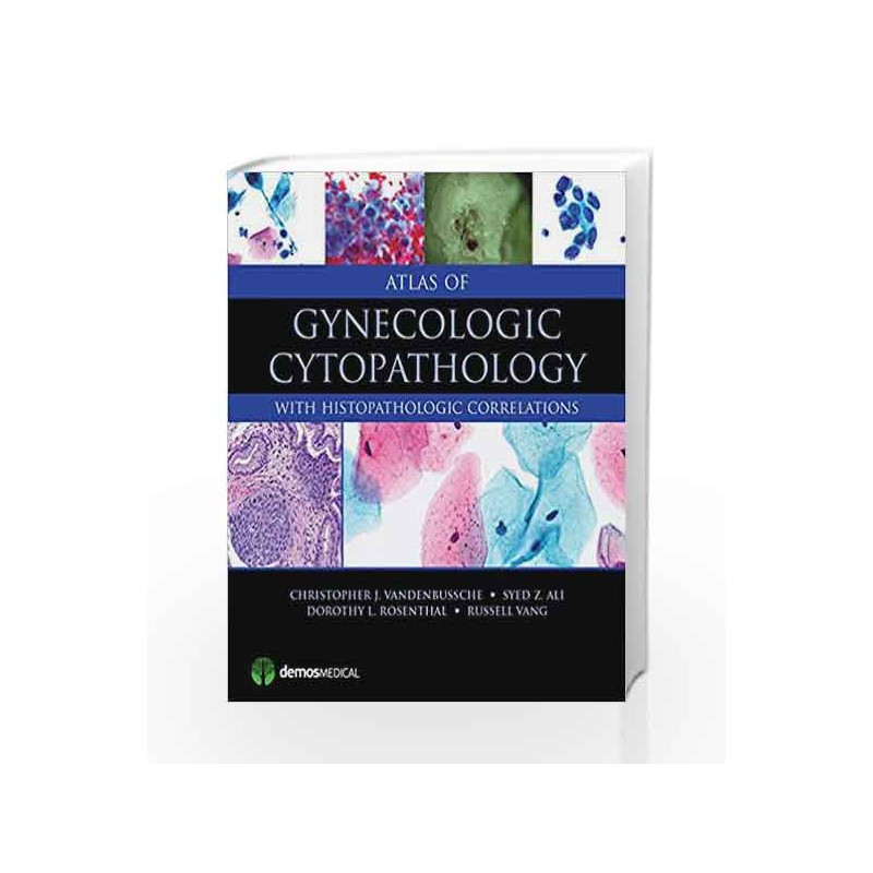 Atlas of Gynecologic Cytopathology: With Histopathologic Correlations by Vandenbussche C J Book-9781620700440