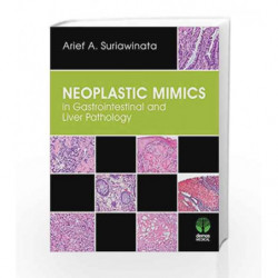 Neoplastic Mimics in Gastrointestinal and Liver Pathology (Pathology of Neoplastic Mimics) by Suriawinata A A Book-9781620700365