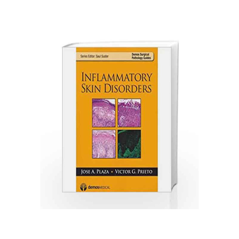 Inflammatory Skin Disorders (Pb 2012) by Plaza J A Book-9781933864877