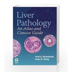 Liver Pathology An Atlas And Concise Guide(Ex) by Suriawinata A A Book-9781933864945