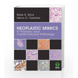 Neoplastic Mimics in Thoracic and Cardiovascular Pathology (Pathology of Neoplastic Mimics) by Wick M.R. Book-9781620700136