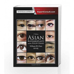 Asian Blepharoplasty and the Eyelid Crease: Expert Consult - Online and Print by Chen W P Book-9780323355728