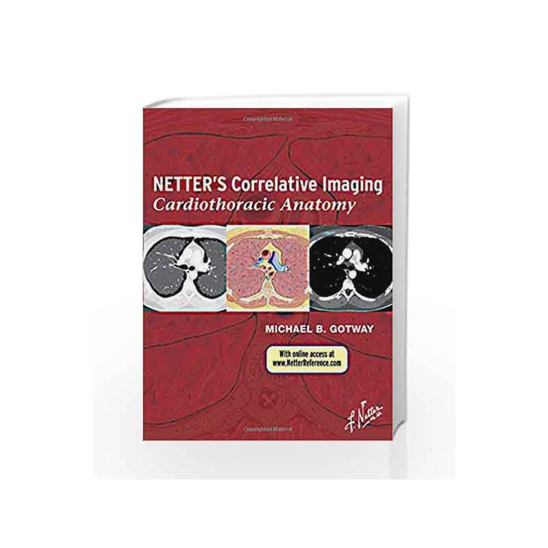 Netter's Correlative Imaging: Cardiothoracic Anatomy: with Online Access (Netter Clinical Science) by Gotway M.B. Book-978143770