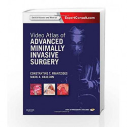 Video Atlas of Advanced Minimally Invasive Surgery: Expert Consult - Online and Print by Frantzides C.T. Book-9781437727234