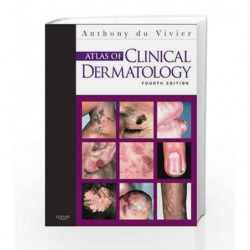 Atlas of Clinical Dermatology by Vivier A.D. Book-9780702034213