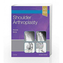 Shoulder Arthroplasty, 2e by Edwards T B Book-9780323529402