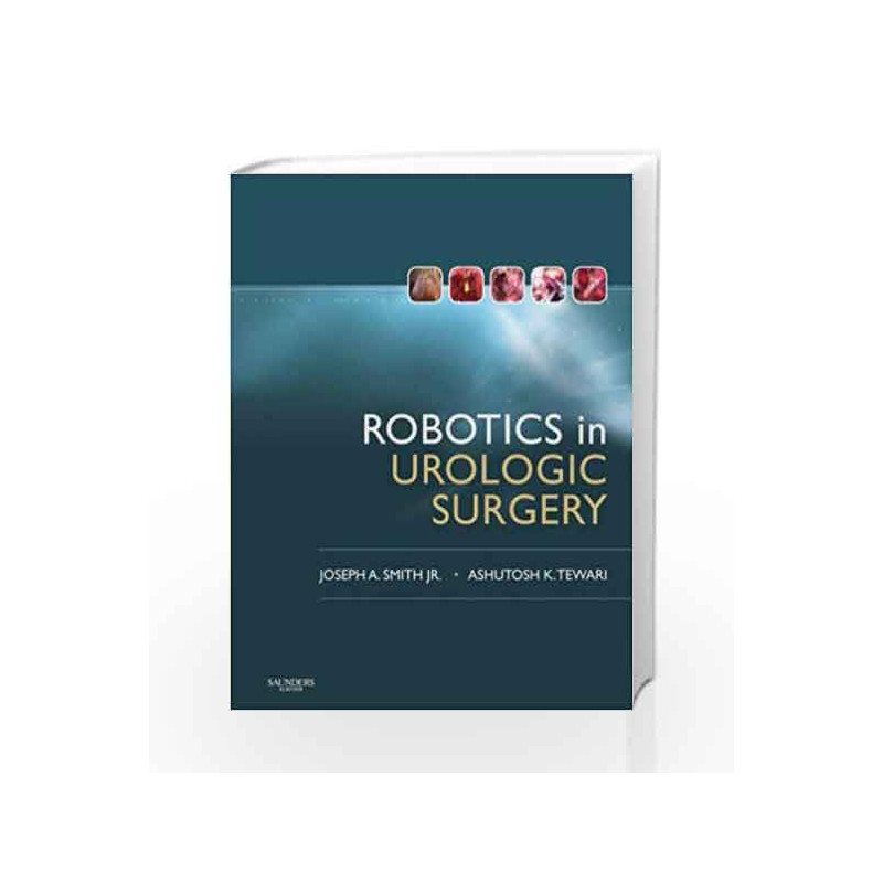 Robotics in Urologic Surgery: Book with DVD, 1e by Smith Book-9781416024651