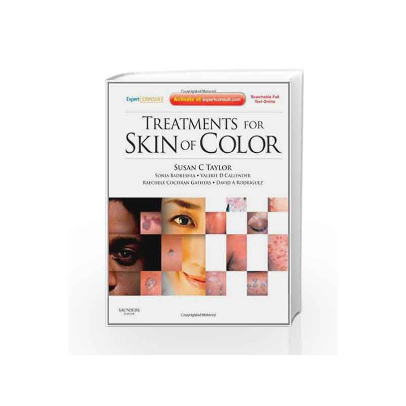 Treatments for Skin of Color Expert Consult - Online and Print (Expert Consult Title: Online + Print) by Taylor S.C. Book-978143