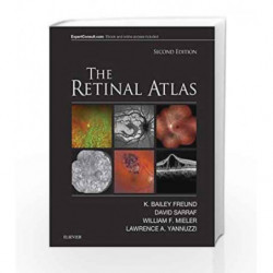 The Retinal Atlas, 2e by Freund K B Book-9780323287920