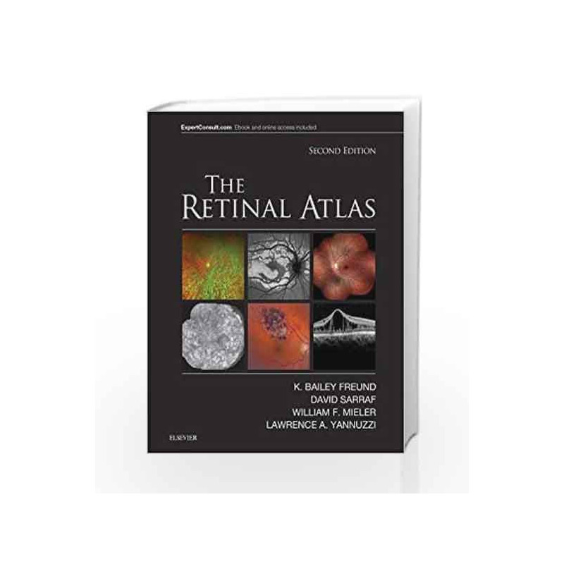The Retinal Atlas, 2e by Freund K B Book-9780323287920