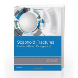 Scaphoid Fractures: Evidence-Based Management, 1e by Buijze G Book-9780323485647