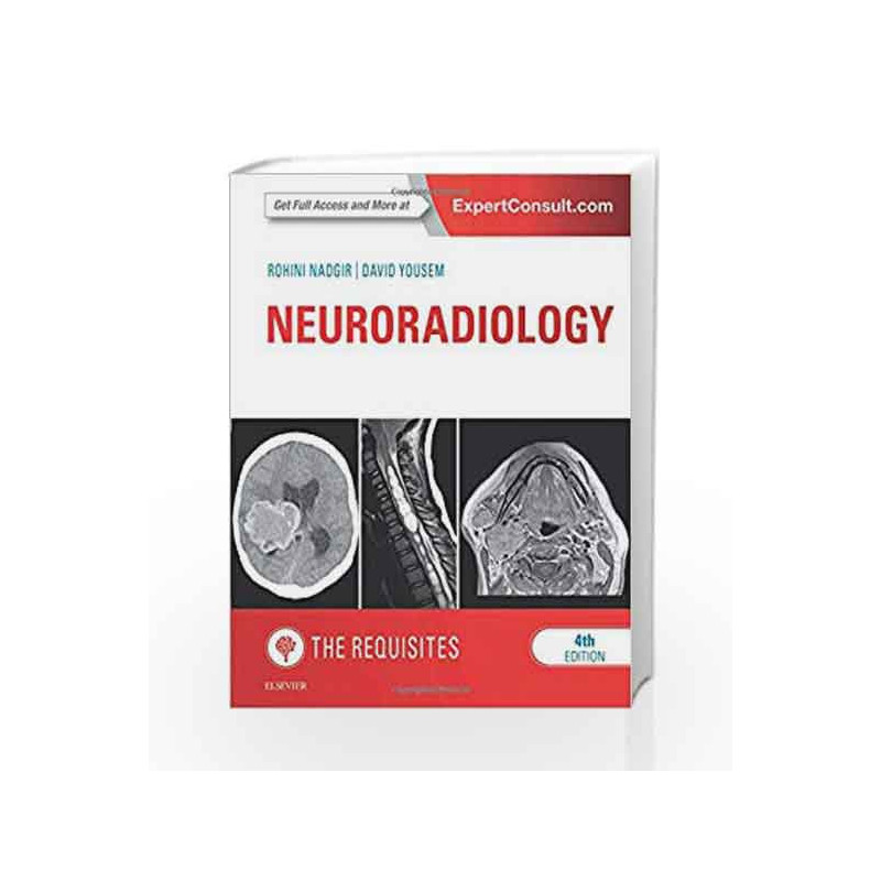 Neuroradiology: The Requisites, 4e (Requisites in Radiology) by Nadgir R Book-9781455775682