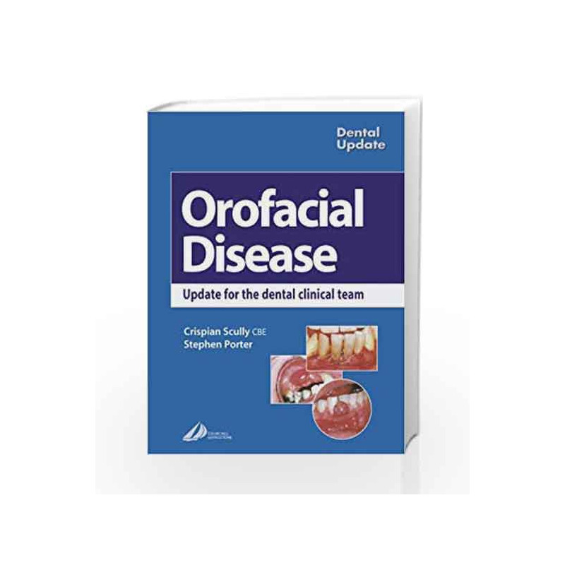 Oral Facial Disease: A Guide for the Dental Clinical Team (Dental Update) by Scully Book-9780443071843