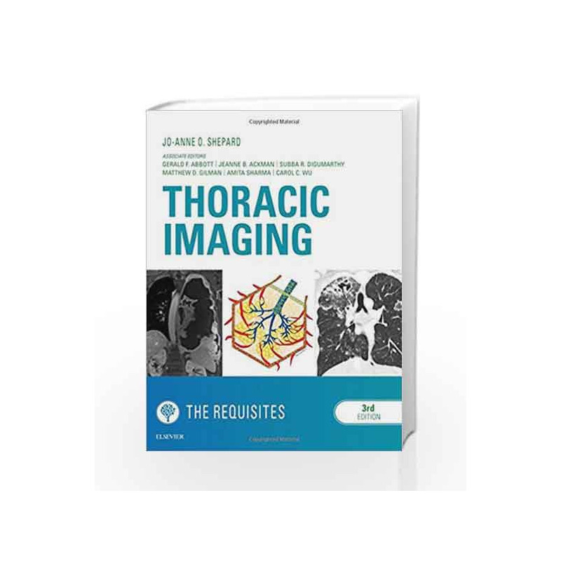 Thoracic Imaging The Requisites, 3e (Requisites in Radiology) by Shepard J A O Book-9780323448864