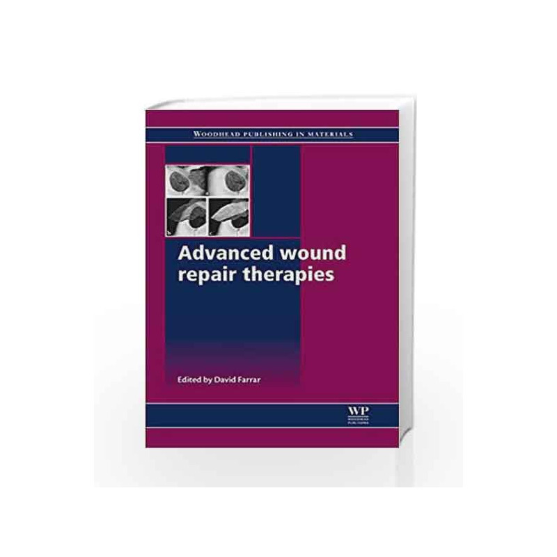 Advanced Wound Repair Therapies (Woodhead Publishing Series in Biomaterials) by Farrar D Book-9781845697006