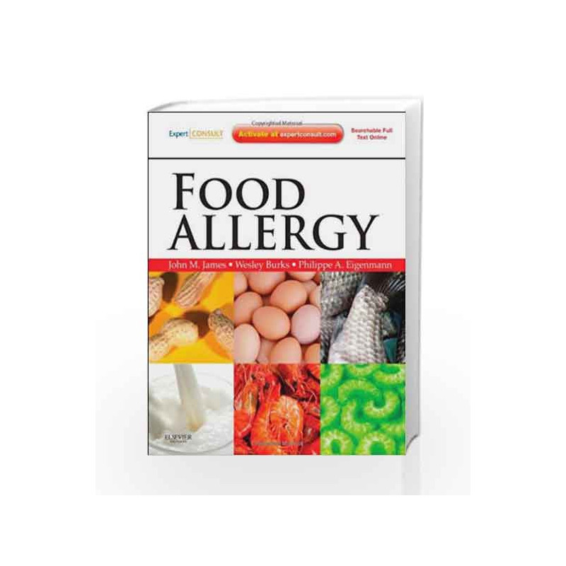 Food Allergy: Expert Consult Basic by James J.M. Book-9781437719925