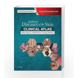 Andrews' Diseases of the Skin Clinical Atlas, 1e by James W D Book-9780323441964