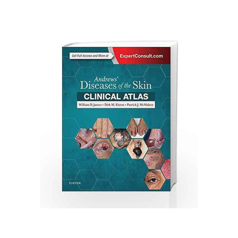 Andrews' Diseases of the Skin Clinical Atlas, 1e by James W D Book-9780323441964