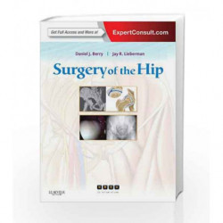 Surgery of the Hip: Expert Consult - Online and Print by Berry D.J. Book-9780443069918