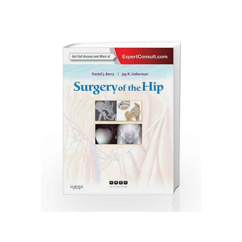 Surgery of the Hip: Expert Consult - Online and Print by Berry D.J. Book-9780443069918