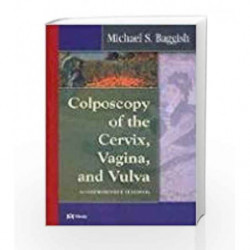 Colposcopy of the Cervix, Vagina, and Vulva: A Comprehensive Textbook by Baggish Book-9780323018593