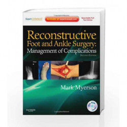Reconstructive Foot and Ankle Surgery: Management of Complications : Expert Consult - Online, Print and DVD by Myerson Book-9781