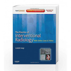 The Practice of Interventional Radiology, with online cases and video: Expert Consult Premium Edition - Enhanced Online Features