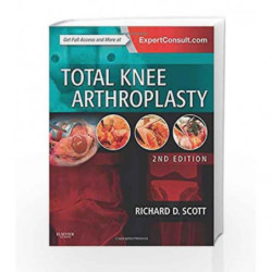 Total Knee Arthroplasty by Scott R D Book-9780323286633