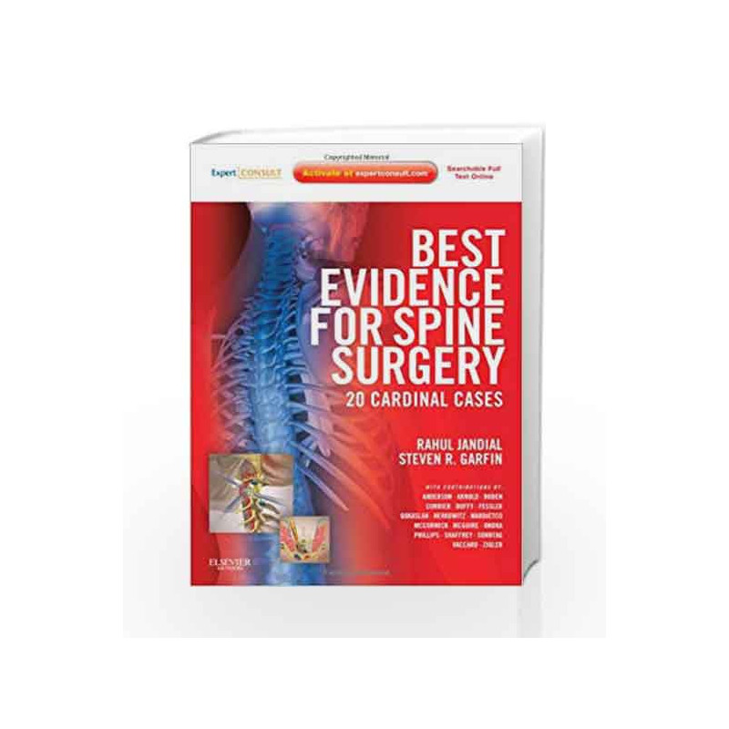 Best Evidence for Spine Surgery: 20 Cardinal Cases Expert Consult ...