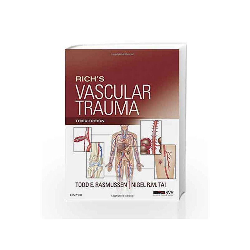 Rich's Vascular Trauma by Rasmussen T.E. Book-9781455712618