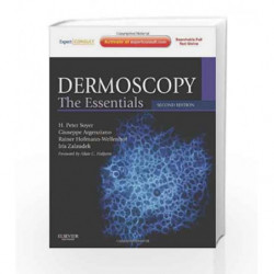 Dermoscopy: The Essentials: Expert Consult - Online and Print by Soyer H.P. Book-9780723435921