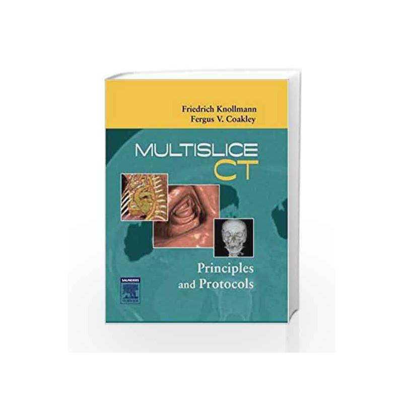 Multislice CT: Principles and Protocols by Knollmann Book-9781416002680