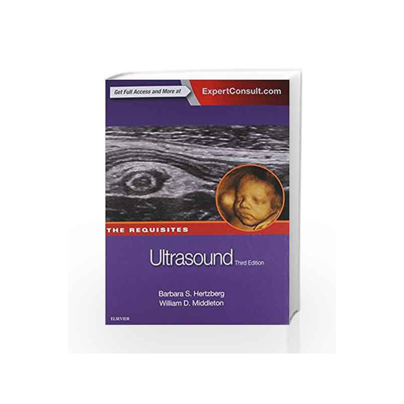 Ultrasound: The Requisites (Requisites in Radiology) by Hertzberg B S Book-9780323086189