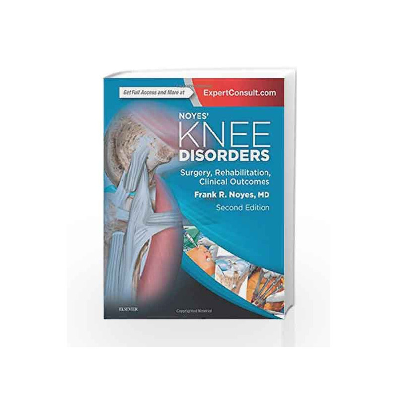 Noyes' Knee Disorders: Surgery, Rehabilitation, Clinical Outcomes by Noyes F.R Book-9780323329033