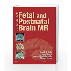 Atlas of Fetal and Postnatal Brain MR by Griffiths Book-9780323052962