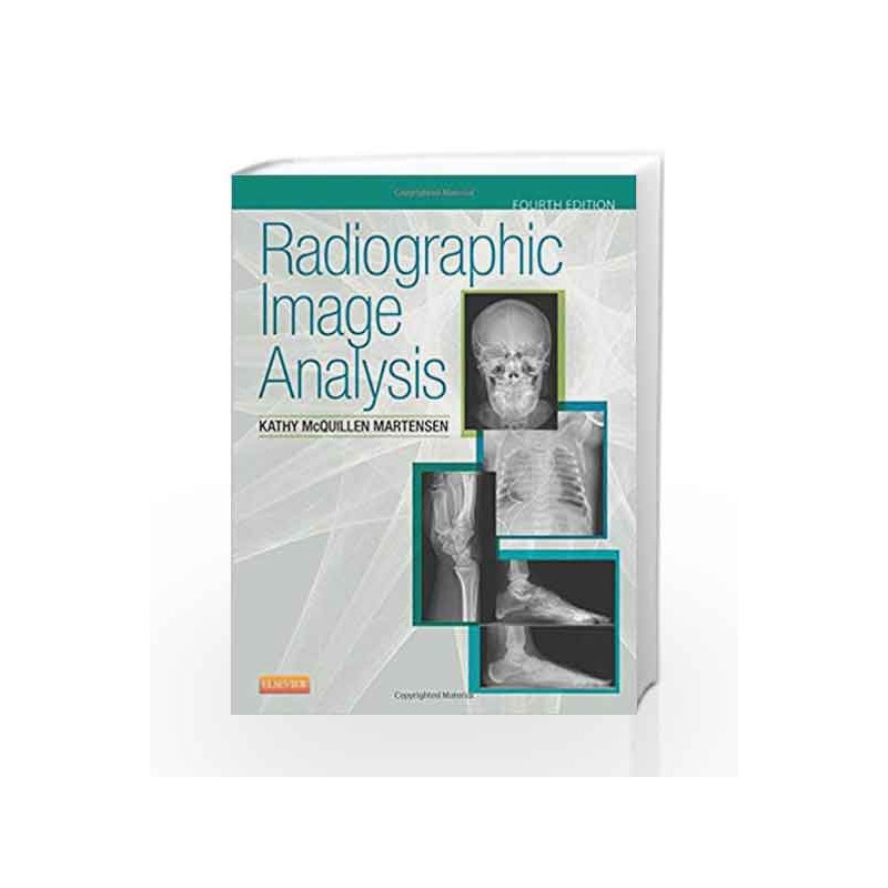 Radiographic Image Analysis by Martensen K M Book-9780323280525