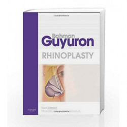 Rhinoplasty: Expert Consult Premium Edition - Enhanced Online Features and Print by Guyuron B Book-9781416037514