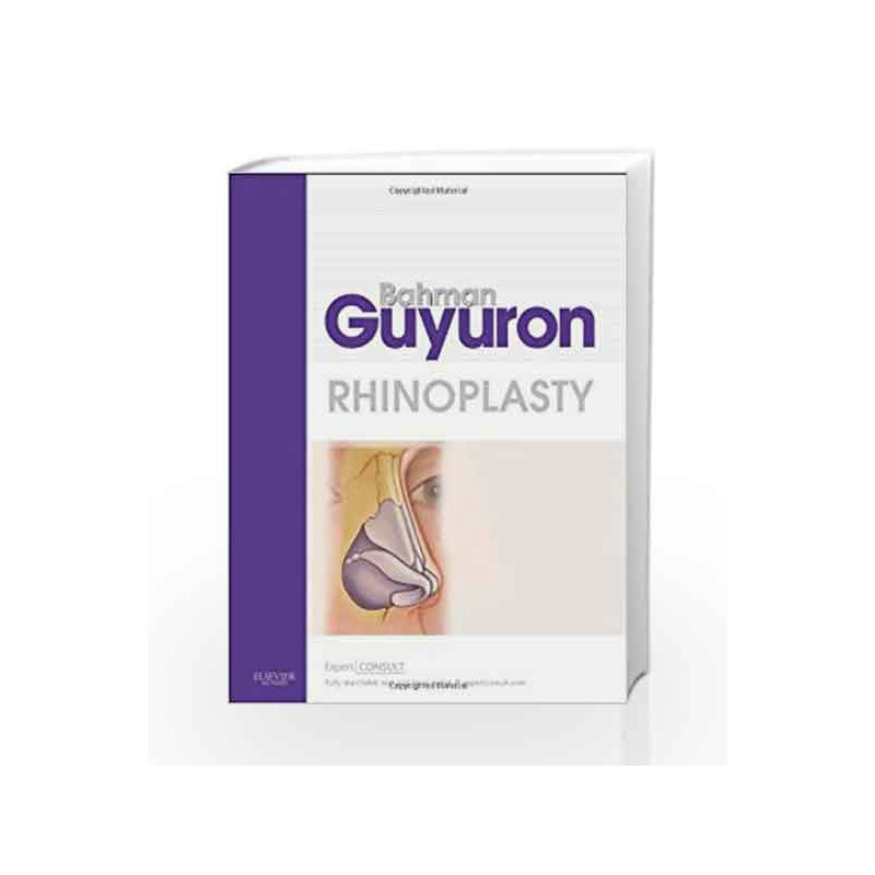 Rhinoplasty: Expert Consult Premium Edition - Enhanced Online Features and Print by Guyuron B Book-9781416037514